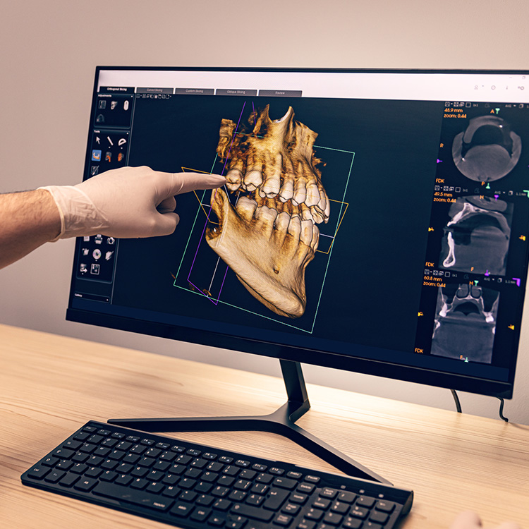 3D CBCT