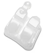 3M Clarity Advanced Ceramic Braces.