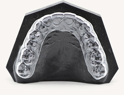 Clear Retainer