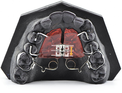 Special Expanders