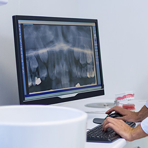 Dental X-Ray