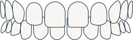 Spacing
