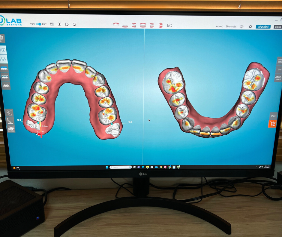 San Diego Orthodontist Revolutionizes Patient Care with Digital Workflows and 3D Printing