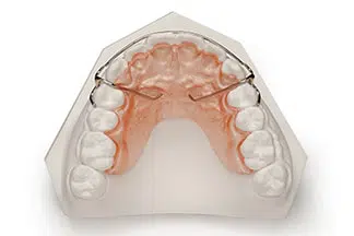 Hawley Retainers Pros and Cons