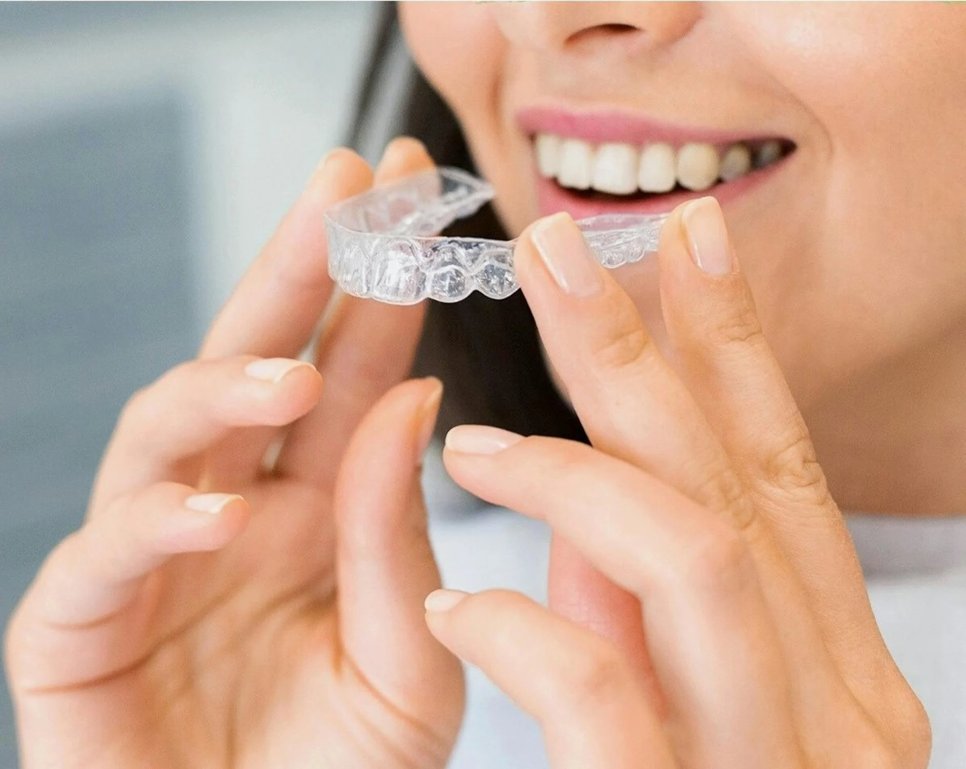 Invisalign vs Metal Braces